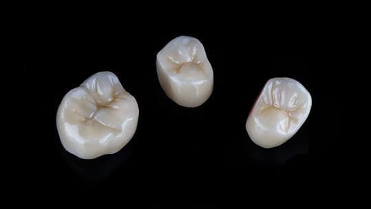 Three dental crowns made of quality ceramic