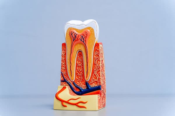 A dental x-ray reviewed before a root canal procedure